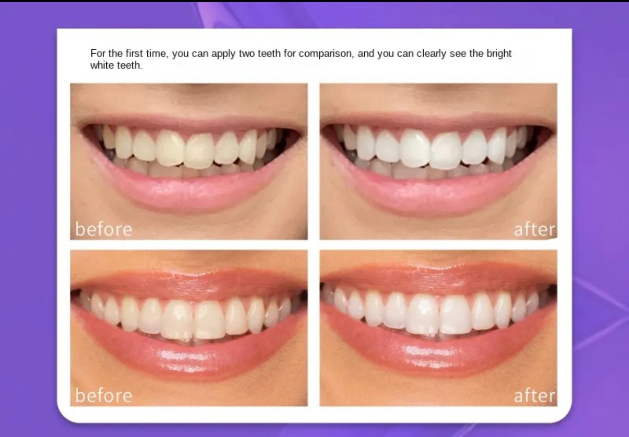 Hismile Teeth Brightening Serum (30ml)